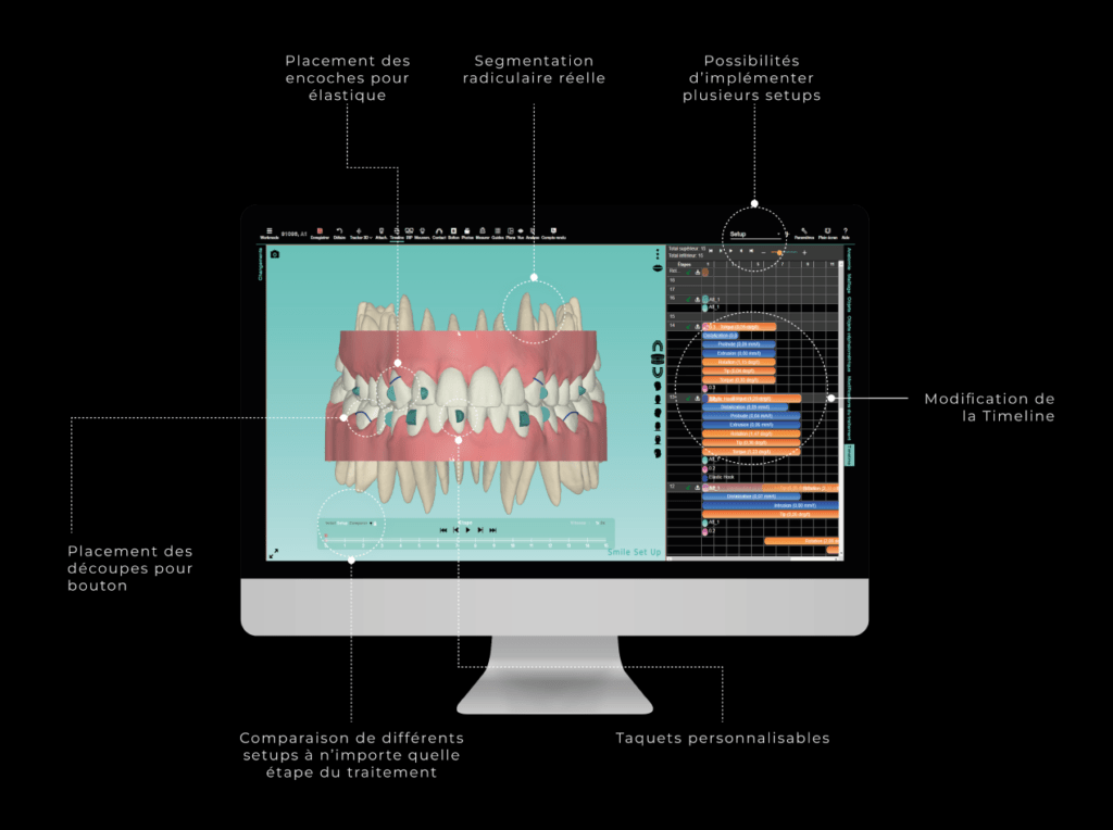 Logiciel Smile Set Up explications